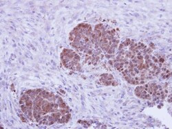 ZNF259 Antibody, Novus Biologicals 0.1mL; Unlabeled:Antibodies, Polyclonal
