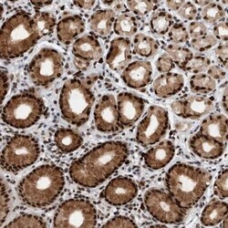 ZNF260 Antibody, Novus Biologicals 25ul | Buy Online | Novus Biologicals | Fisher Scientific