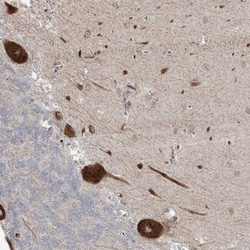 ZNF263 Antibody, Novus Biologicals:Antibodies:Primary Antibodies