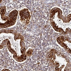 ZNF268 Antibody, Novus Biologicals 25 &mu;L, Unlabeled:Antibodies, Polyclonal