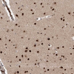 ZNF280D Antibody, Novus Biologicals 0.1mL; Unlabeled:Antibodies, Polyclonal