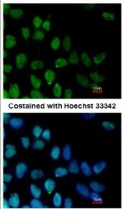 ZNF281 Antibody, Novus Biologicals 0.1mL; Unlabeled:Antibodies, Polyclonal