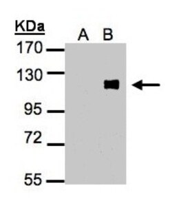 ZNF281 Antibody, Novus Biologicals 0.1mL; Unlabeled:Antibodies, Polyclonal