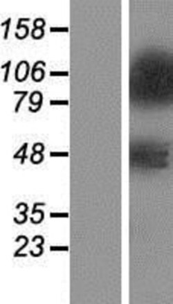 Novus Biologicals&trade;&nbsp;ZNF281 Overexpression Lysate