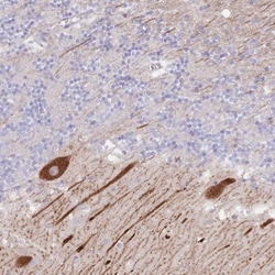 ZNF281 Antibody, Novus Biologicals 25 &mu;L, Unlabeled:Antibodies, Polyclonal