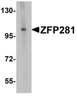 ZNF281 Antibody - BSA Free, Novus Biologicals:Antibodies:Primary Antibodies