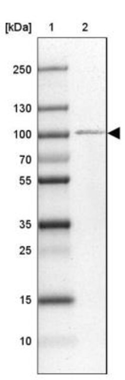ZNF281 Antibody, Novus Biologicals 25 &mu;L, Unlabeled:Antibodies, Polyclonal