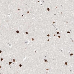 ZNF282 Antibody, Novus Biologicals:Antibodies:Primary Antibodies