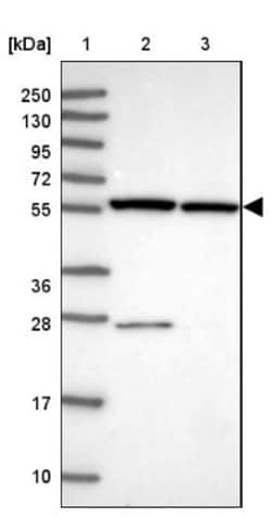 ZNF285A Antibody, Novus Biologicals:Antibodies:Primary Antibodies
