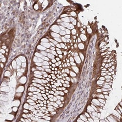 ZNF285A Antibody, Novus Biologicals:Antibodies:Primary Antibodies