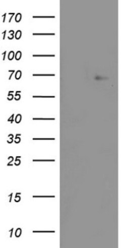 ZNF286 Antibody (OTI7D2), Novus Biologicals 0.1mL; Unlabeled:Antibodies,
