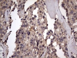 ZNF286 Antibody (OTI7D2), Novus Biologicals 0.1mL; Unlabeled:Antibodies,