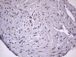 ZNF286 Antibody (OTI7D2), Novus Biologicals 0.1mL; Unlabeled:Antibodies,