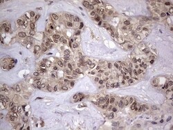 ZNF286 Antibody (OTI7D2), Novus Biologicals 0.1mL; Unlabeled:Antibodies,