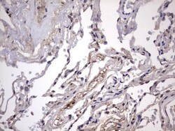 ZNF286 Antibody (OTI7D2), Novus Biologicals 0.1mL; Unlabeled:Antibodies,