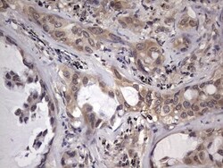 ZNF286 Antibody (OTI7D2), Novus Biologicals 0.1mL; Unlabeled:Antibodies,