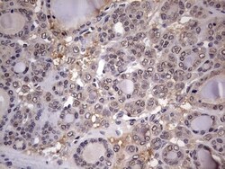 ZNF286 Antibody (OTI7D2), Novus Biologicals 0.1mL; Unlabeled:Antibodies,