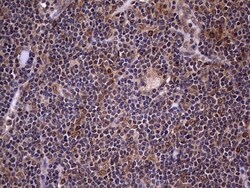 ZNF286 Antibody (OTI7D2), Novus Biologicals 0.1mL; Unlabeled:Antibodies,