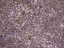 ZNF286 Antibody (OTI7D2), Novus Biologicals 0.1mL; Unlabeled:Antibodies,