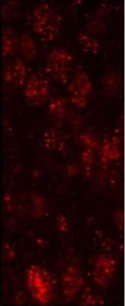 ZNF295 Antibody, Novus Biologicals 0.1mg; Unlabeled:Antibodies, Polyclonal