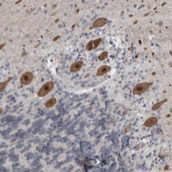 ZNF295 Antibody, Novus Biologicals 0.1mL; Unlabeled:Antibodies, Polyclonal