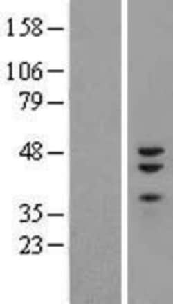 Novus Biologicals&trade;&nbsp;ZNF3 Overexpression Lysate