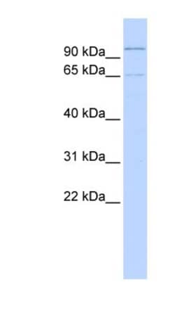 ZNF30 Antibody, Novus Biologicals 100&mu;L; Unlabeled:Antibodies, Polyclonal