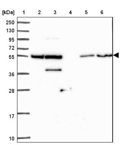 ZNF300 Antibody, Novus Biologicals 0.1 mL | Buy Online | Novus Biologicals | Fisher Scientific