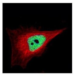 ZNF302 Antibody, Novus Biologicals 0.1mL; Unlabeled:Antibodies, Polyclonal