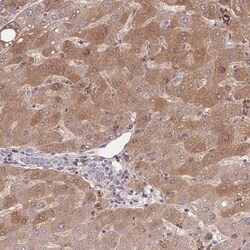 ZNF304 Antibody, Novus Biologicals:Antibodies:Primary Antibodies