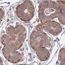 ZNF304 Antibody, Novus Biologicals:Antibodies:Primary Antibodies