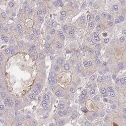 ZNF304 Antibody, Novus Biologicals:Antibodies:Primary Antibodies