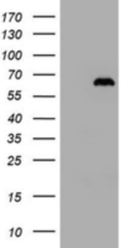 ZNF307 Antibody (OTI6G6), Novus Biologicals 0.1mL; Unlabeled:Antibodies,