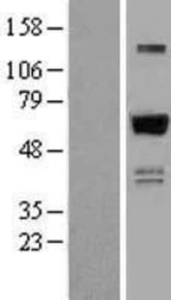 Novus Biologicals&trade;&nbsp;ZNF307 Overexpression Lysate