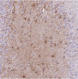 ZNF311 Antibody, Novus Biologicals 25 &mu;L, Unlabeled:Antibodies, Polyclonal