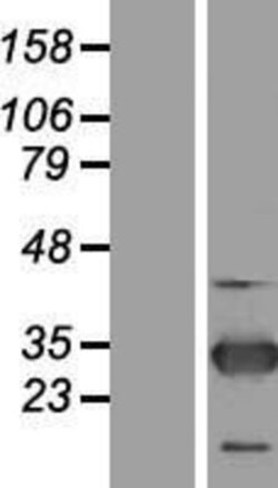 Novus Biologicals&trade;&nbsp;ZNF313 Overexpression Lysate
