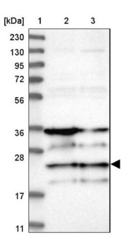 ZNF313 Antibody, Novus Biologicals 25 &mu;L; Unlabeled:Antibodies, Polyclonal