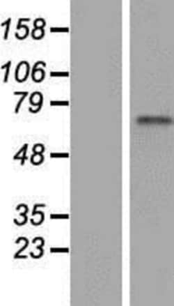 Novus Biologicals&trade;&nbsp;ZNF317 Overexpression Lysate
