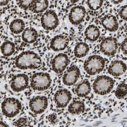 ZNF31 Antibody, Novus Biologicals 0.1mL; Unlabeled:Antibodies, Polyclonal