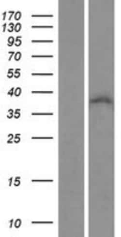 Novus Biologicals&trade;&nbsp;ZNF32 Overexpression Lysate