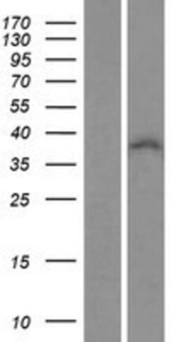 Novus Biologicals&trade;&nbsp;ZNF32 Overexpression Lysate