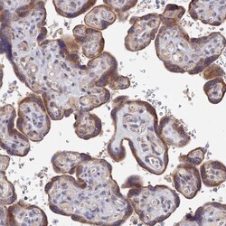 ZNF320 Antibody, Novus Biologicals 0.1mL; Unlabeled:Antibodies, Polyclonal