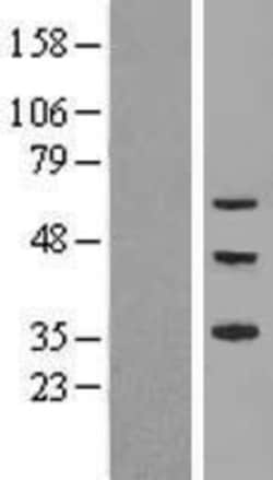 Novus Biologicals&trade;&nbsp;ZNF320 Overexpression Lysate