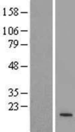 Novus Biologicals™ ZNF321 Overexpression Lysate