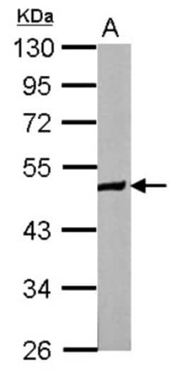 ZNF322A Antibody, Novus Biologicals 0.1mL; Unlabeled:Antibodies, Polyclonal
