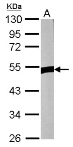 ZNF322A Antibody, Novus Biologicals 0.1mL; Unlabeled:Antibodies, Polyclonal