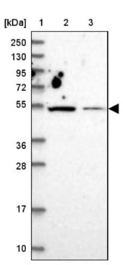 ZNF322A Antibody, Novus Biologicals 25 &mu;L | Buy Online | Novus Biologicals | Fisher Scientific