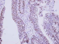 ZNF329 Antibody, Novus Biologicals 0.1mL; Unlabeled:Antibodies, Polyclonal