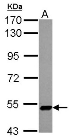 ZNF329 Antibody, Novus Biologicals 0.1mL; Unlabeled:Antibodies, Polyclonal