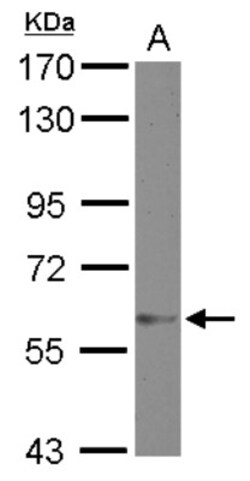 ZNF329 Antibody, Novus Biologicals 0.1mL; Unlabeled:Antibodies, Polyclonal